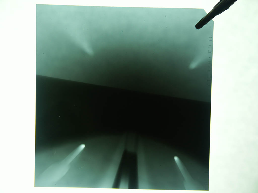 Xray shadows of the tube itself